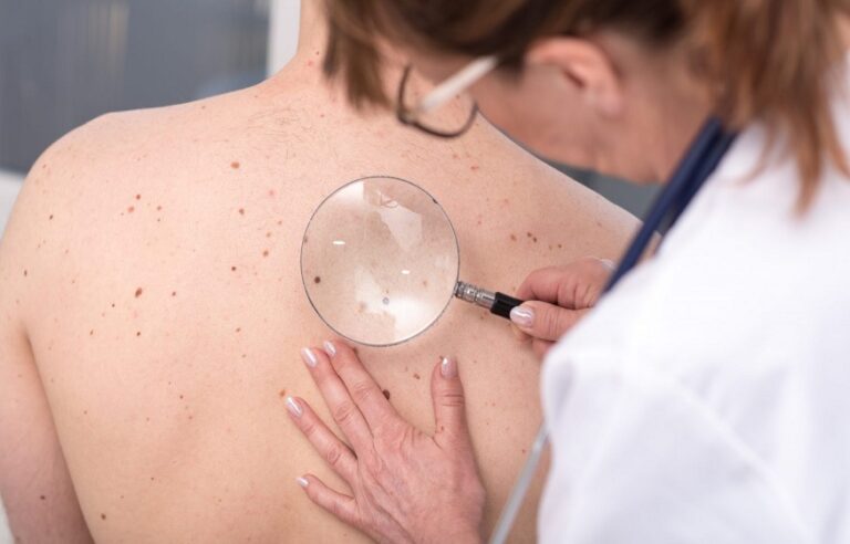 Supportive care for non-melanoma skin cancer