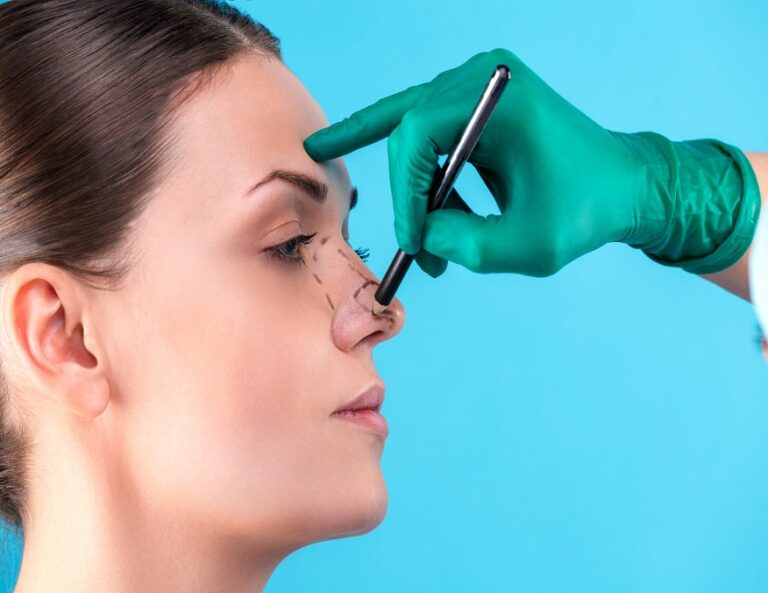 Mastering the Art of Scar Prevention After Rhinoplasty