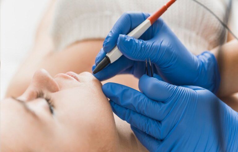 The Future of Hair Removal: Understanding Advanced Electrolysis Techniques