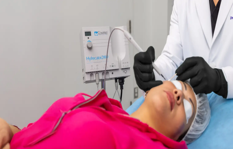 Age Spot Removal: Refined, Non-Surgical Solutions at EyeFACE Institute, Toronto